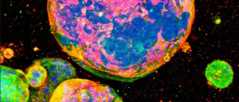 Кіотські науковці вирощують колоректальний рак у 3D на «визначеній» матриці: крок до відтворюваних органоїдів